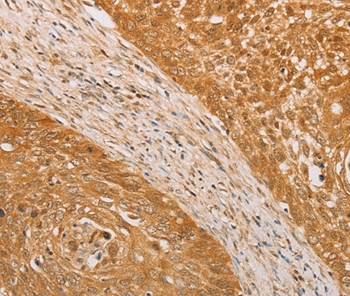 STK40 Antibody[36201]