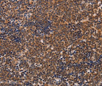 ADH1A Antibody[36075]