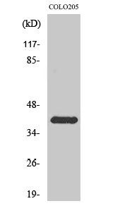 Rhodopsin Polyclonal Antibody[