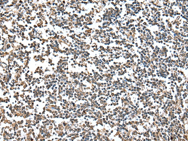 HIF1AN Antibody[42894]