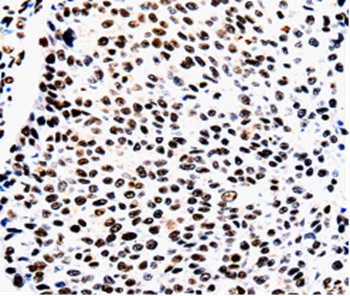AQP2 Antibody[36759]