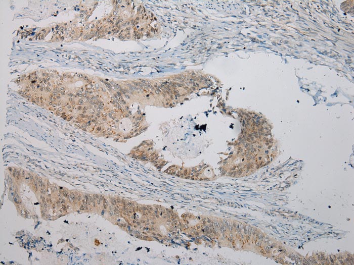 UGT1A6 Antibody[43176]