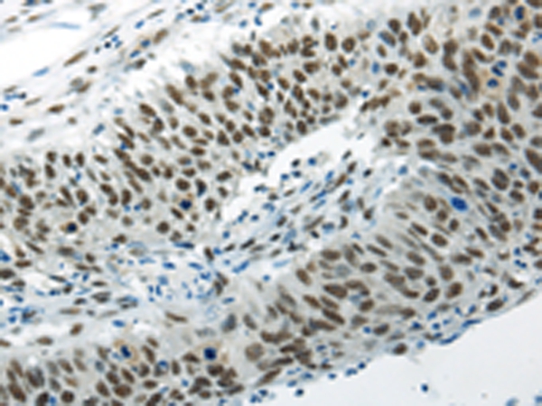 HNRNPM Antibody[43188]