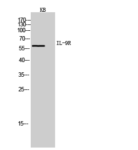 IL-9R Polyclonal Antibody[4197
