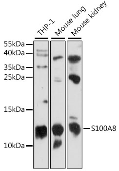 S100A8 Polyclonal Antibody[292