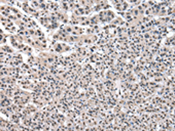 PTBP1 Antibody[43006]