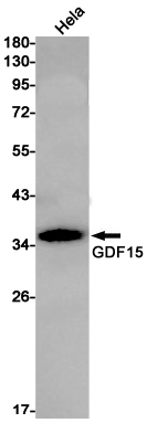 GDF15 Rabbit mAb[52304]