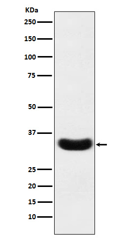 Scramblase 1 Rabbit mAb[56605]