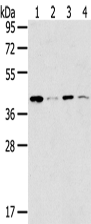 MAGEA11 Antibody[43138]