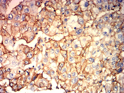 HLA-C Mouse mAb[63732]