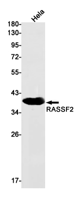 RASSF2 Rabbit mAb[52546]