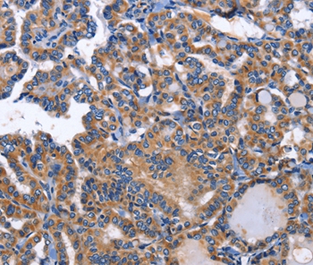 INHBC Antibody[35781]