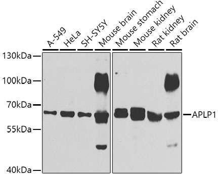 APLP1 Rabbit Polyclonal Antibo
