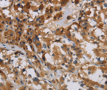 LOXL4 Antibody[36389]