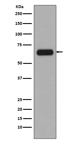 TCF3 Rabbit mAb[56049]
