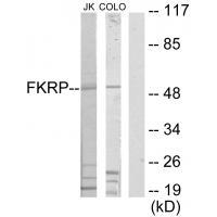 FKRP Antibody[34068]