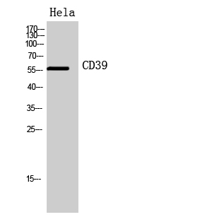 CD39 Polyclonal Antibody[41951