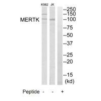 MERTK Antibody[35290]