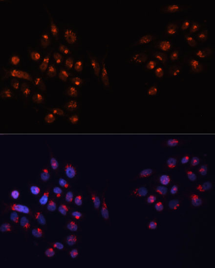 GM130 Rabbit Polyclonal Antibo