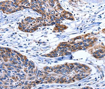 AQP8 Antibody[36812]