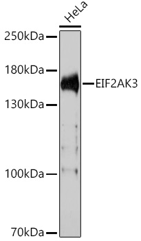 EIF2AK3 Rabbit Polyclonal Anti