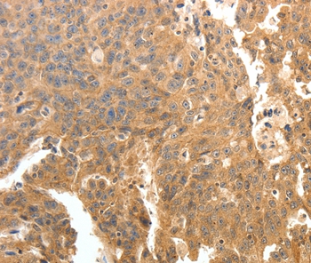 PTPRE Antibody[35900]