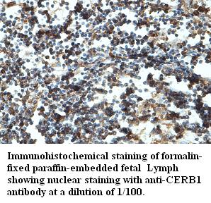 CERB1 Antibody[39430]