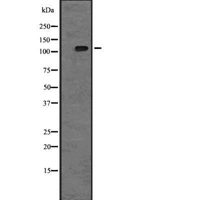 TAOK2 Antibody[44892]