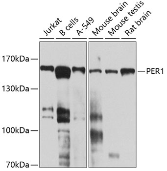 PER1 Rabbit Polyclonal Antibod