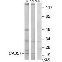 CA057 Antibody[34044]