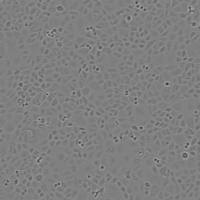 EOMA小鼠血管内皮瘤细胞