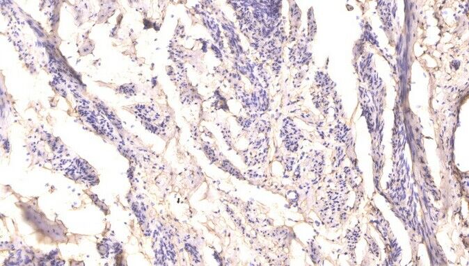 RIP (phospho-Ser166)  rabbit p