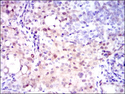 ASS1 Mouse mAb[63096]
