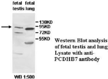 PCDHB7 Antibody[39536]