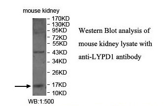 LYPD1 Antibody[39909]