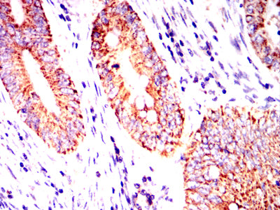 MUC13 Mouse mAb[63965]