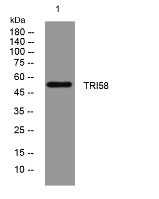TRI58 rabbit pAb[49640]