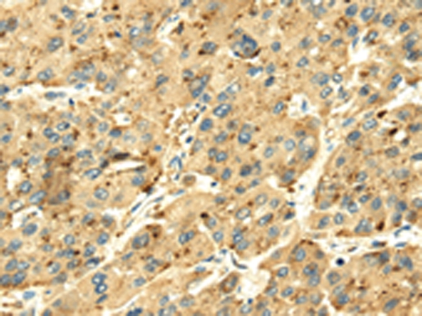 SENP2 Antibody[42749]