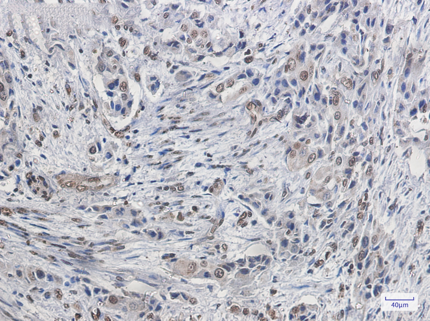 FBP1 Rabbit mAb[52279]