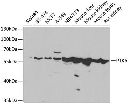 PTK6 Rabbit Polyclonal Antibod