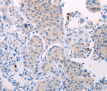 TEKT4 Antibody[35960]