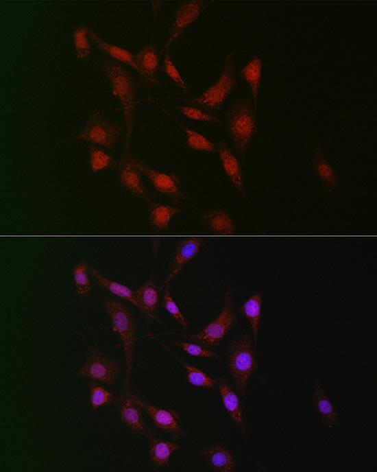 WBP11 Rabbit Polyclonal Antibo