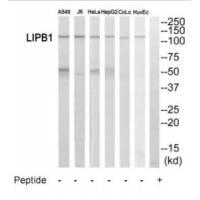 LIPB1 Antibody[35188]