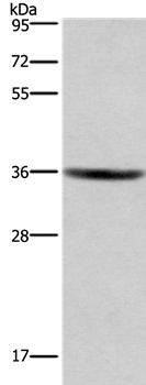 GPR171 Antibody[37604]