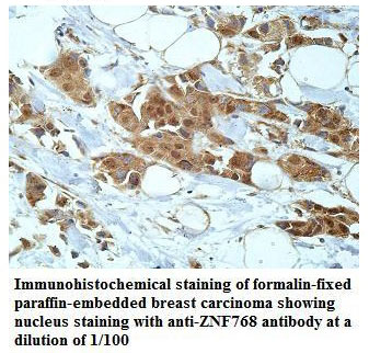 ZNF768 Antibody[39918]