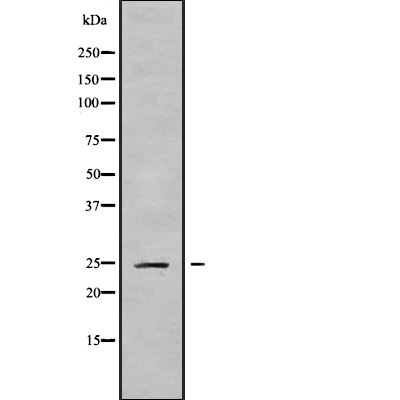 CABP2 Antibody[45826]
