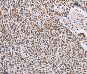 THOC7 Antibody[36221]