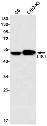LIS1 Rabbit mAb[52398]