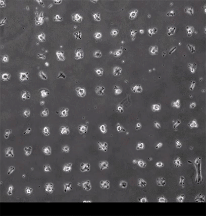 定格癌魔一举一动：从肿瘤微环境到显微视域