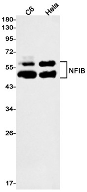 NFIB Rabbit mAb[52460]